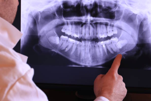 Best Broken or Chipped Tooth Repair in Citrus Park, FL
